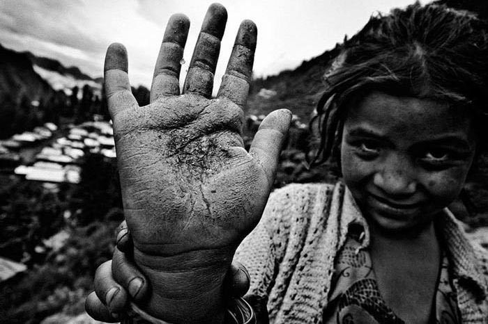 Photograph by Harikrishna Katragadda A girl shows the hand of a cannabis field worker (not in picture) in Malana